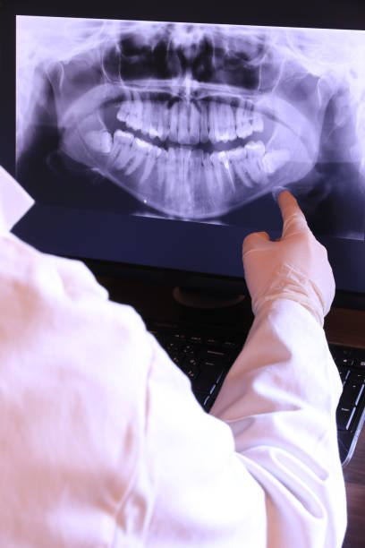 Best Emergency Dental Extractions in Somerset, PA