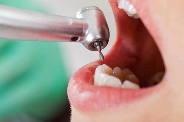 Best Broken or Cracked Tooth Emergency Dentist in Somerset, PA